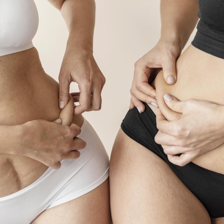 Wymrażanie tkanki tłuszczowej. Czy faktycznie usuwa brzuch i boczki?